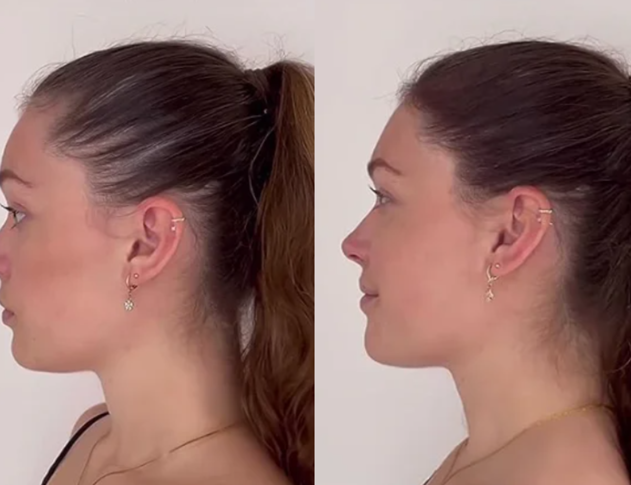 Lustrao Hair Growth Trio-2