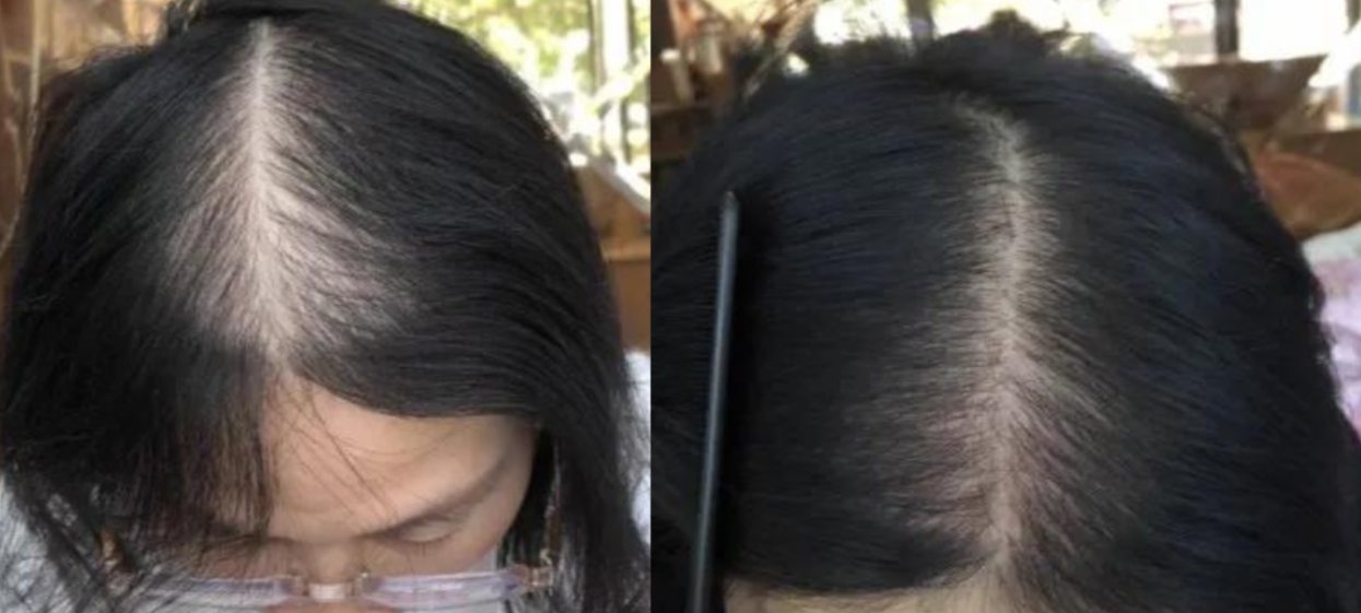 Lustrao Hair Growth Trio-4
