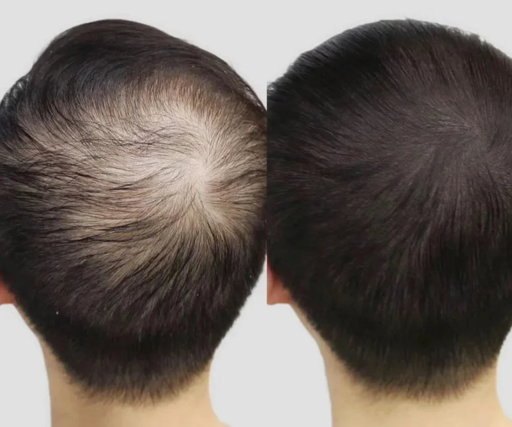 Lustrao Hair Growth Trio-3